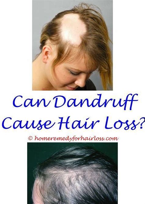 Try to find out everything you can about hair loss and the treatment options available to you. causes of excessive hair loss in older females - hair loss ...