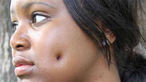 Unfortunately, not all beutiful girls have dimples.anatomically. Dimpleplasty: Woman Gets £1,500 Cheek Piercing Surgery To ...