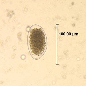 A pap smear can help detect changes in the cervix caused by hpv. Papillomavirus homme gorge symptomes - LES INFECTIoNS ...