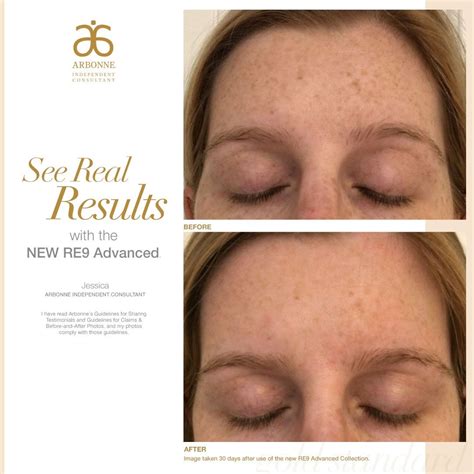 Reviewing kris kristoffersons new boxed set. Arbonne NEW RE9 Advanced Skincare Collection Results ...