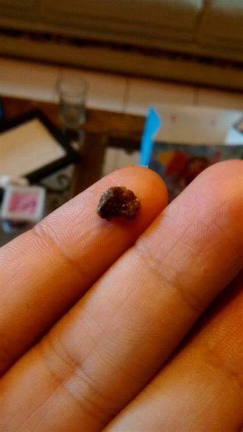 However, people with the following symptoms should speak to a doctor for a full diagnosis and treatment recommendations: This just fell out of my ear. Now I can hear … - Reddit