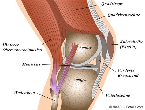 Knieschmerzen können sowohl unterhalb der kniescheibe, seitlich innen im gelenk, außen oder in der kniekehle entstehen. Eine Übersicht zum Thema Knieschmerzen - Kniespezialist ...