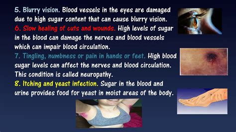 Make sure to check why you should do something about this. Diabetes Symptoms, Signs and Complications - YouTube