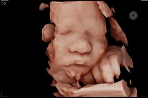 We did not find results for: When is the Best Time to Get a 3D Ultrasound? - 3D4D Baby ...