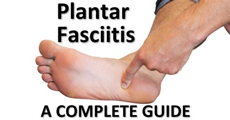 Research has now confirmed that acupuncture is an effective treatment for plantar fasciitis and other types of heel pain. Plantar Fasciitis - Our Complete Guide | Cornerstone ...