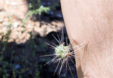 But, as a precaution i think it's important to know what to do, in case you accidentally get stuck. How to Remove Cactus Spines From Skin With Tweezer & Glue ...