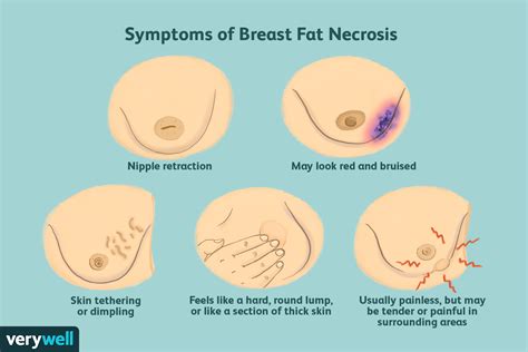 Read about what makes teeth sensitive, and how to avoid risk of tooth decay and gum disease. Fascinating creating a breast like form