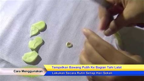 Sejatinya, cara menghilangkan tahi lalat ada sangat banyak, loh! Cara Cepat Alami Hilangkan Tahi Lalat Dengan Bawang Putih ...