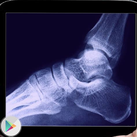 Xray clothes scanner simulator 1.0 apk description. Download XRay Clothes Scanner Google Play softwares ...