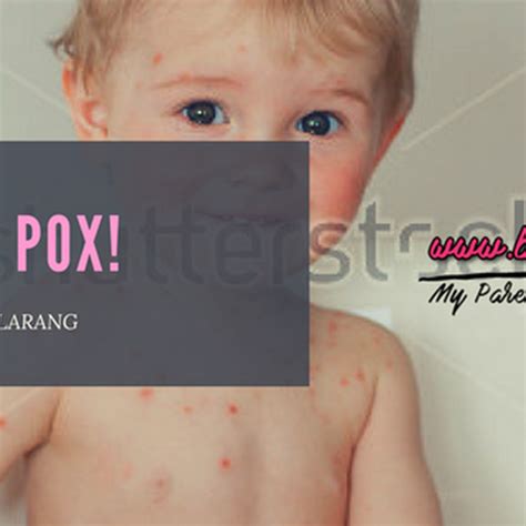 But, both diseases can cause lesions anywhere in the body including internal cavities and both can leave deep scars. CHICKEN POX! Petua & Pantang Larang - Bubblynotes ...