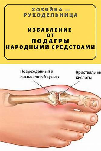 Сбросить вес народными средствами Лечение подагры народными средствами — Хозяйка — Рукодельница Лечение подагры народными средствами — Хозяйка — Рукодельница Сбросить вес народными средствами