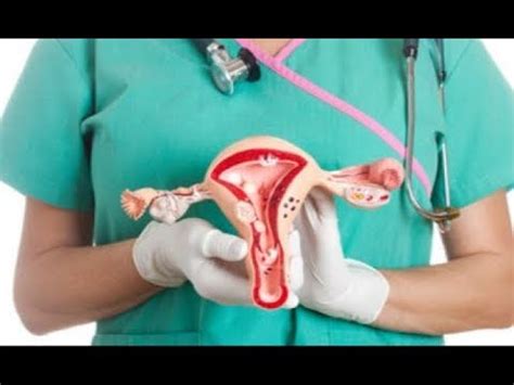 A diferencia de otros tumores, los síntomas del cáncer de útero o endometrio suelen aparecer cuando aún está en fases precoces. Como Identificar os Sintomas do Câncer de Colo de Úte - YouTube