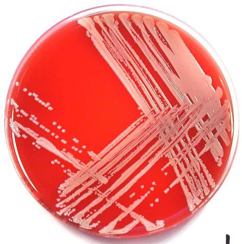 Pseudomonas infections occur due to a specific type of bacteria and can affect different areas of the body. Staphylococcus xylosus