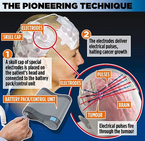In the last 20 years, the american population as a whole has seen an increase of about 22 percent, and in people older than 65, that uptick in brain tumors is about 55 percent, according to statistics from the surveillance, epidemiology and end results (seer) program of the national cancer institute. How a skull cap could help to zap deadly brain cancer ...