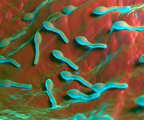 Clostridium tetani is an obligate anaerobic bacteria whose spores produce two distinct toxins—tetanolysin, which causes local tissue destruction, and tetanospasmin, which causes clinical. Clostridium tetani bacterium - Stock Image - F018/7808 ...