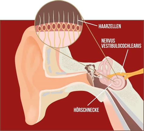 Mehr zu den ursachen des tinnitus. Schematische Darstellung Ohr