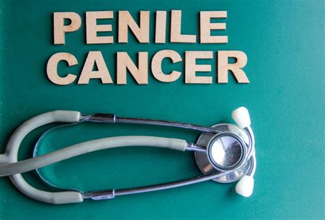 Check spelling or type a new query. Penile Cancer - UltraCorePower