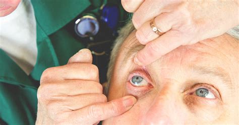 This time varies according to the kind of drops utilized, as well as the color of your eyes. How Long Does Eye Dilation Last? What to Expect, Tips, and ...