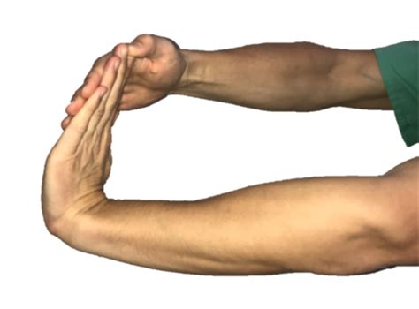 If the tennis elbow stretches below help decrease the pain in your elbow, then they are effective? What is tennis elbow? — Joseph J. Schreiber, MD