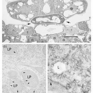 It is indeed a treasure trove of phytochemicals and a rich source of both cellulosic and woody fibers. Scanning electron micrographs of diverse eudicot glandular ...