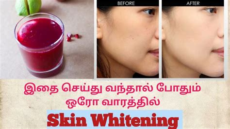 Skin Whitening Tips in Tamil | Home Remedis Skin Whitening ...