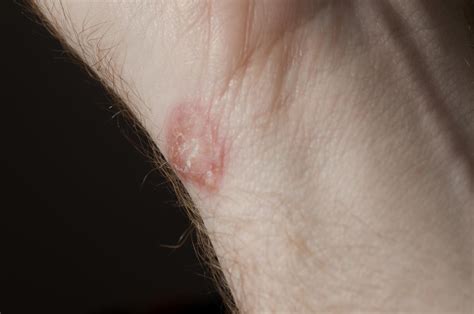 What is the proper way to use hand sanitizer? Does Hand Sanitizer Kill Ringworm : It's important to use ...