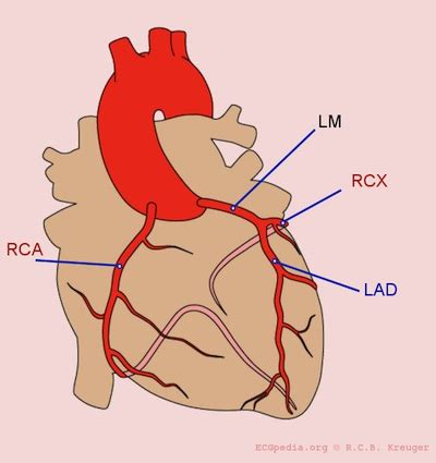 Analysis of 207 cadaver coronary arteries showed left coronary artery (lca) dominance type was present in 6.3% of there were also differences in the number of diagonal arteries in the dissected samples. Acute Coronary Syndrome