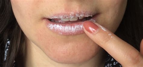 Molte persone usano questa crema senza conoscerne i ...
