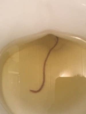 Maybe you would like to learn more about one of these? Worm In Toilet Probably Not From Reader's Body - All About ...