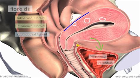 The uterus is divided into several layers that have distinct structural and functional characteristics. Clinical Reproductive Anatomy - Uterus - 3D Anatomy ...