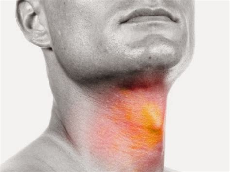 You may have a lump in your neck caused by an enlarged lymph node. Lump In Throat Neck - Sex Movies Pron