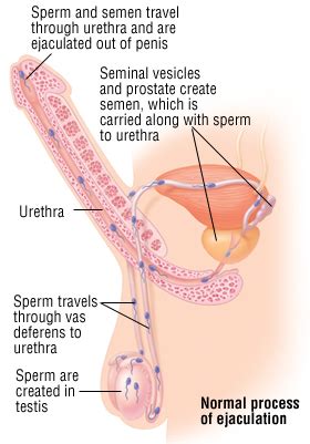 Firstly let me make something clear: Premature Ejaculation. Causes, symptoms, treatment ...