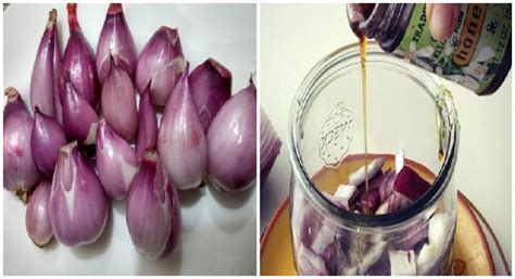 Bahkan seorang pria pun bisa sampai menangis ketika menderita sakit gigi. Cukup Dengan Ramuan Bawang Merah, Terbukti Ampuh Usir ...