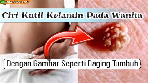 Check spelling or type a new query. Ciri Kutil Kelamin Pada Wanita Dengan Gambar Seperti ...