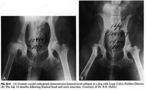 Perthes disease affects a wide age range of children but the most common age range is between 4 perthes disease goes through 4 stages. Disease, Legg. Causes, symptoms, treatment Disease, Legg