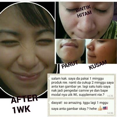 Jacksonmachadoposted on 28.05.2021 опубликовано в без рубрики no comments. Mamadil Women Love Beauty Sara : Awak Alergi Kolagen Ikan ...