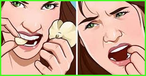 Learn about pain after a wisdom tooth extraction or from wisdom teeth coming through and how to manage it at home. How To Deal With Wisdom Tooth Pain At Home - 16 Home ...