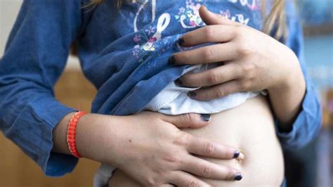 Beim auftreten von symptomen hat die zyste bereits eine gewisse größe; Wann muss Blinddarmentzündung bei Kindern operiert werden ...