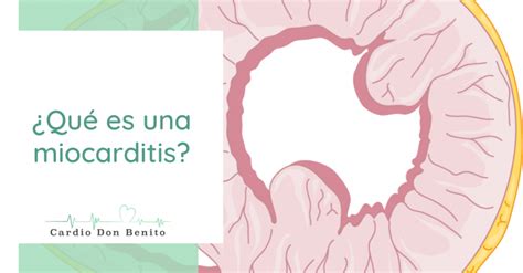 La miocarditis es una inflamación que se produce en el músculo cardíaco, es decir, en el la miocarditis puede afectar al músculo y al sistema eléctrico del corazón, reduciendo la capacidad. ¿Qué es una miocarditis? ¿Puede tener complicaciones graves?