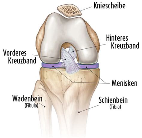 Eis sollte, wenn überhaupt, nur in den ersten sekunden bis minuten nach einer verletzung zur dämpfung der schmerzen genutzt werden. Kreuzbandriss (vorderes Kreuzband) » Infos zu OP & Reha