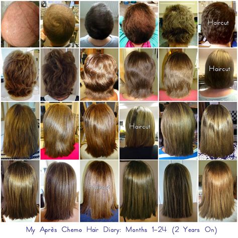 High doses of radiation may cause permanent damage to the hair follicles, causing. Jojo's Journey: Hair Diary