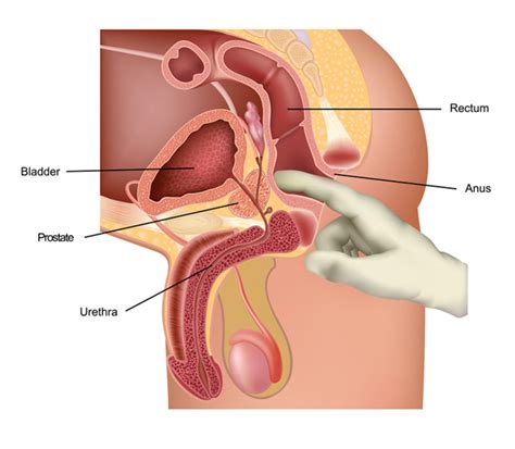 An mri machine is essentially a large, powerful magnet. How Can You Stimulate Prostate? | New Health Advisor