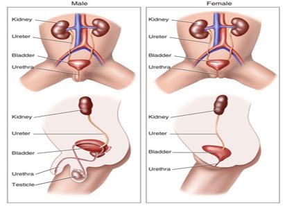 Blood in the urine, straining to urinate, and making repeated frequent attempts to urinate are. Bladder Cancer Symptoms | Modern Cancer Hospital Guangzhou ...