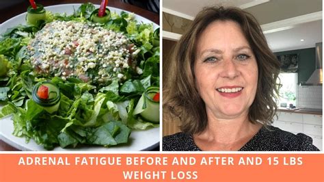 Adrenal fatigue causes hair loss through cortisol dysregulation. Adrenal Fatigue Before And After With 15 Lbs Weight Loss ...