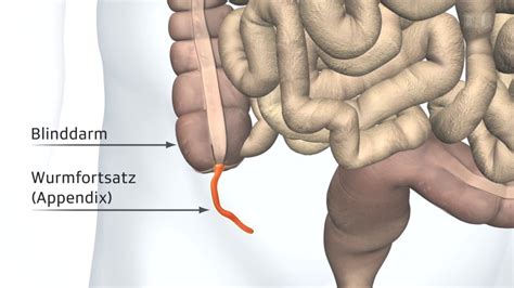 Der blinddarm (lateinisch caecum, coecum oder cecum bzw. Körper & Geist - Den Blinddarm mit Antibiotika behandeln ...