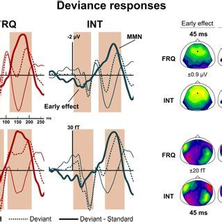 בדיקת eeg היא בדיקה בה מחברים אל הקרקפת מספר אלקטרודות, על מנת לעקוב אחר הפעילות החשמלית של המוח. (PDF) Empirical Bayes evaluation of fused EEG-MEG source ...