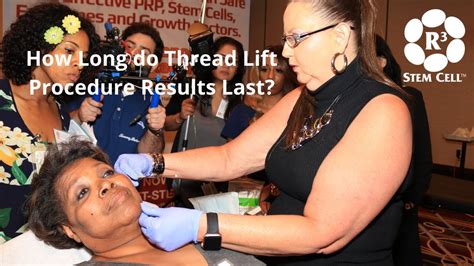 Bruising will dissipate in approximately ten days after the surgery. How Long Does a Thread Lift Procedure Result Last? (844 ...