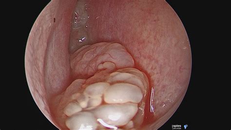 Die luftgefüllten hohlräume sind mit sogenanntem respiratorischen epithel ausgekleidet. Lernen