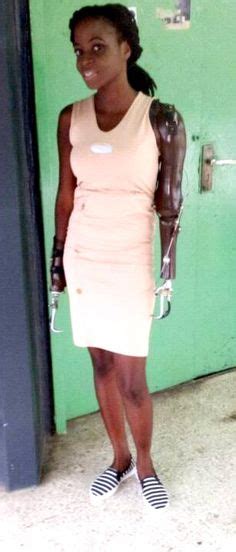 This tag belongs to the additional tags category. 44 Best DAE images | Orthotics, prosthetics, Prosthetic ...