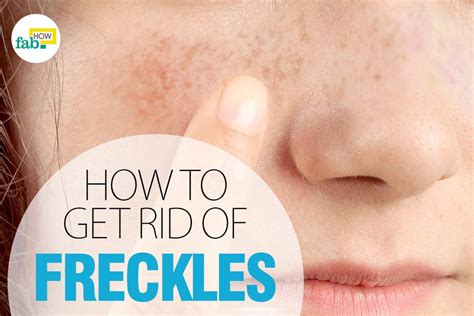 The blood distribution might not run well there and a massage could be depending how dark is the freckles, you can see it gets lighter in 2 weeks to one month. How to Get Rid of Freckles Fast with Lemon Juice | Fab How